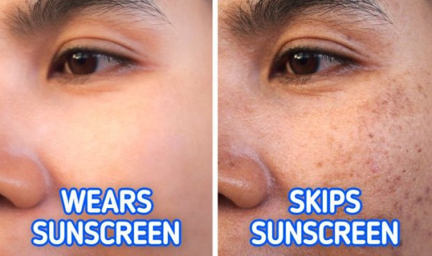 Những lý do vì sao mặt bạn xuất hiện vết thâm và cách khắc phục - Hình 3 Nhung ly do vi sao mat ban xuat hien vet tham va cach khac phuc-Hinh-3