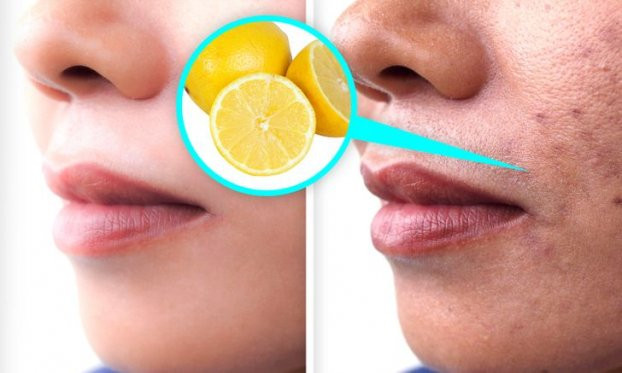 Những lý do vì sao mặt bạn xuất hiện vết thâm và cách khắc phục - Hình 5 Nhung ly do vi sao mat ban xuat hien vet tham va cach khac phuc-Hinh-5