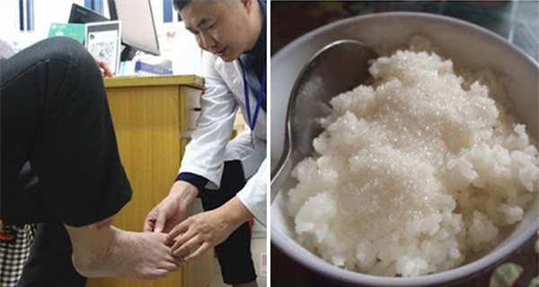 9 thực phẩm là thuốc độc với người bệnh tiểu đường ảnh 1 9 thực phẩm là thuốc độc với người bệnh tiểu đường ảnh 1