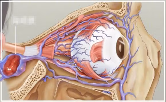 Be trai ngoay mui dua vi khuan vao nao, thoi xau doa giet nguoi-Hinh-3