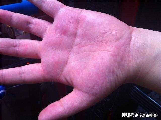 3 dau hieu de thay cua benh ung thu gan-Hinh-3