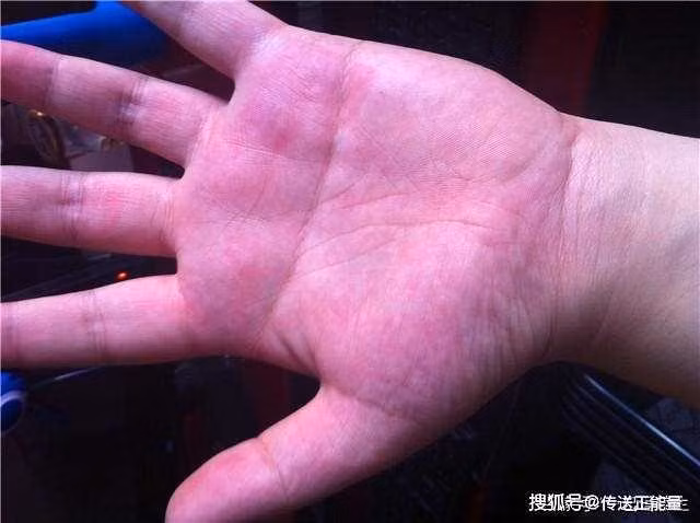 3 dau hieu de thay cua benh ung thu gan-Hinh-3