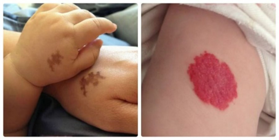 Người sở hữu vết bớt ở 4 vị trí này cả đời giàu sang phú quý Nguoi so huu vet bot o 4 vi tri nay ca doi giau sang phu quy