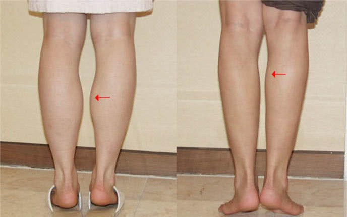 Mach ban cach giam mo bap chan cuc ky de