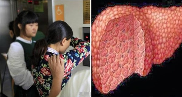 3 thói quen khi ngủ dậy vào buổi sáng hại gan hơn uống rượu ảnh 1