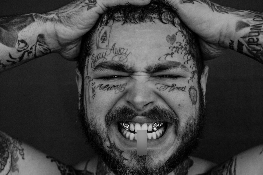 Ngoài việc chi tiền cho đồng hồ sang, Post Malone từng bỏ ra 1,6 triệu USD để dán kim cương lên răng. Nha sĩ Thomas Connelly cho biết ông sử dụng 40 carat kim cương từ Bỉ và Israel để tạo hình răng. Sau khi thành công, ông gọi ca sĩ 26 tuổi là người đàn ông có nụ cười triệu USD.