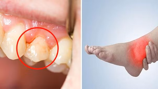 4 trieu chung khi ngu day chung to gan khong tot