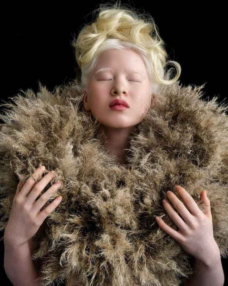 Co gai bach tang bi bo roi tu be lon len noi tieng khong ngo