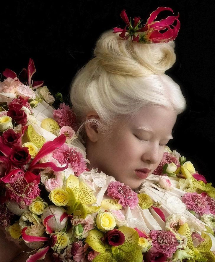 Co gai bach tang bi bo roi tu be lon len noi tieng khong ngo-Hinh-9