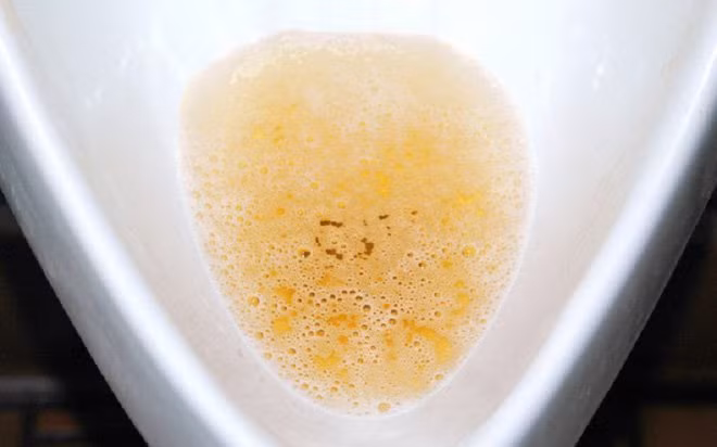 Nguoi co than tot thuong co 5 dac diem khi thuc day vao buoi sang-Hinh-2