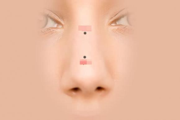 Y nghia cua not ruoi tren mui la gi?-Hinh-2