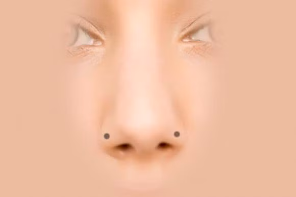 Y nghia cua not ruoi tren mui la gi?-Hinh-3