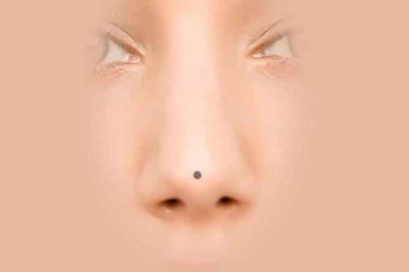 Y nghia cua not ruoi tren mui la gi?-Hinh-4