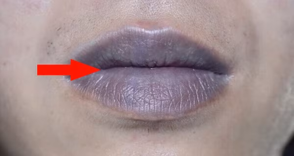 3 bieu hien tren khuon mat cho thay ban co the dang mac benh gan