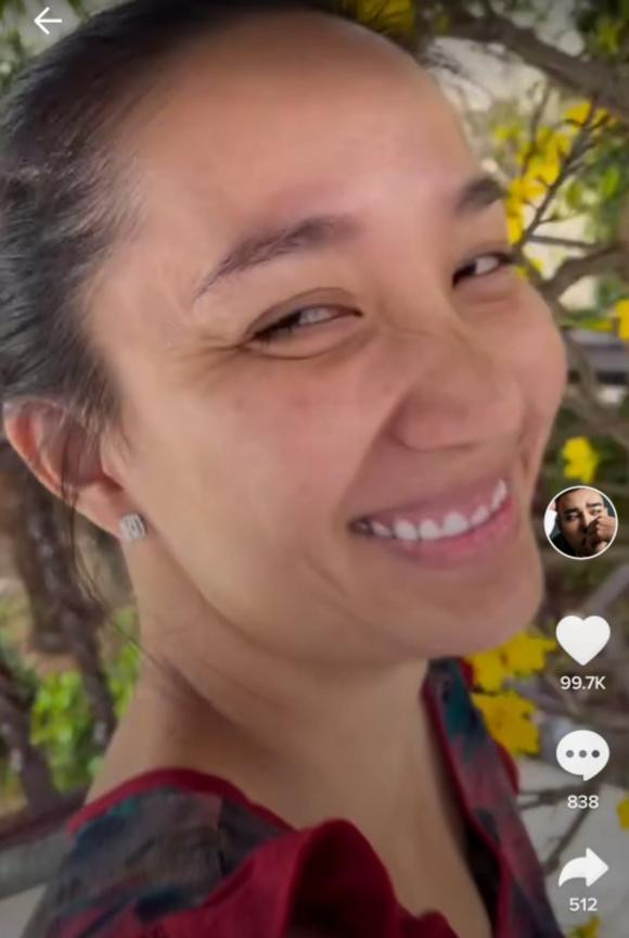 Nhan sac cua ba xa Le Duong Bao Lam sau 2 lan 