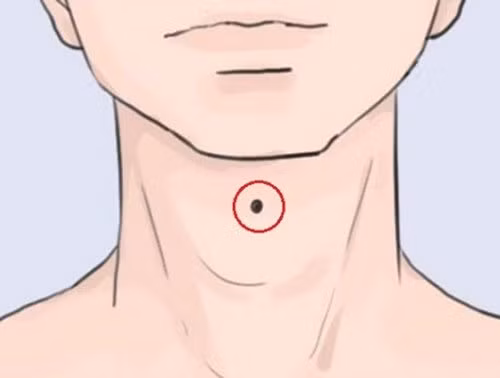 Dan ong so huu 1 trong 4 not ruoi nay: Ca doi khong lo tung thieu