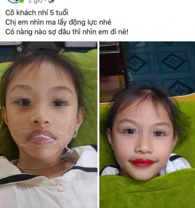 Xôn xao phụ huynh để con gái 5 tuổi xăm môi đỏ Xon xao phu huynh de con gai 5 tuoi xam moi do