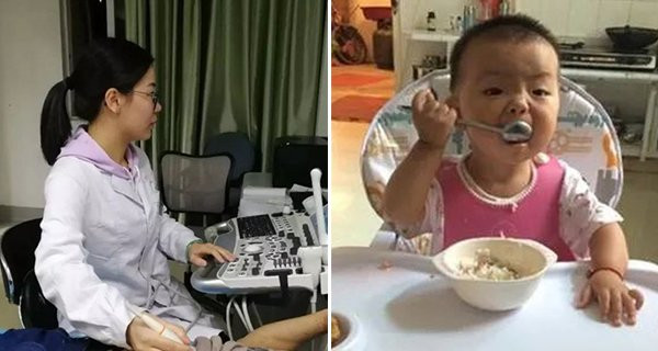 Be 8 thang tuoi bi hoai tu ruot nghiem trong, BS noi: La loi cua me