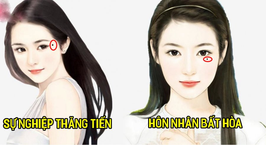 Nam hay nu co 3 not ruoi “tru tai” ca doi khong bao gio ngheo doi