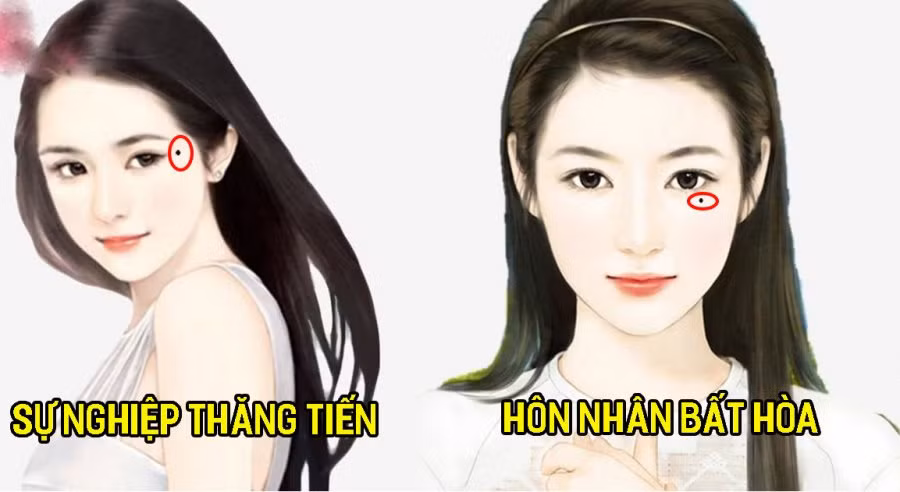 Nam hay nu co 3 not ruoi “tru tai” ca doi khong bao gio ngheo doi