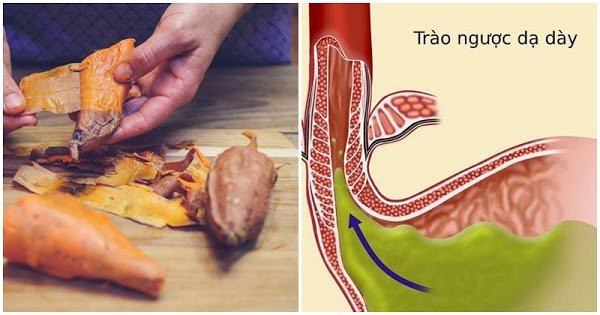 Khoai lang rat tot nhung co 3 thoi diem khong nen an, gay hai ruot