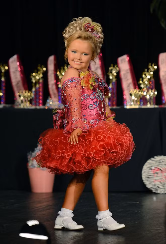 Hoa hau nhi mot thoi bi miet thi vi ve ngoai qua thay doi-Hinh-2