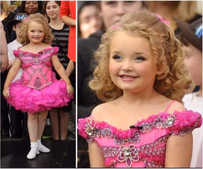 Hoa hau nhi mot thoi bi miet thi vi ve ngoai qua thay doi