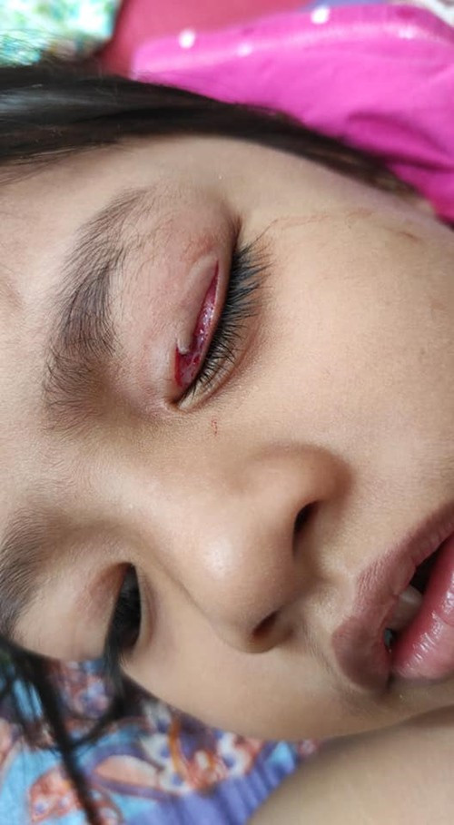 Tai nan xay ra voi co con gai nho vi su vo y cua nguoi me-Hinh-2