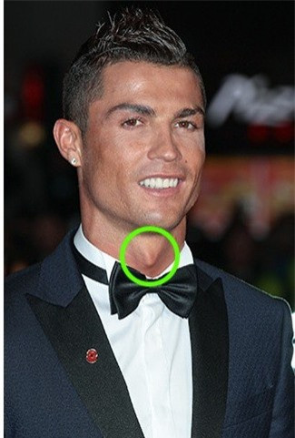 13. Phụ nữ cũng có yết hầu như nam giới. 