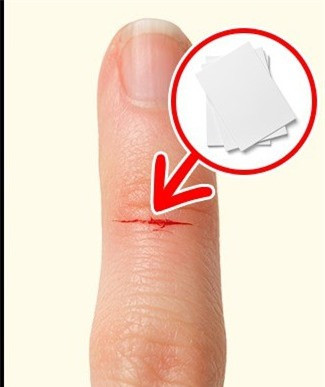 9. Vết cắt sắc, mỏng sẽ khiến bạn cảm thấy đau hơn bình thường.Vết cắt nhỏ nhưng sắc sẽ chảy rất ít máu hoặc không chảy máu tuy nhiên nó tác động đến hệ thần kinh và khiến bạn cảm thấy đau nhức.