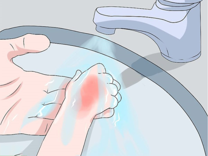 Chuyên gia Viện Bỏng khuyến cáo khi dùng miếng dán giữ nhiệt Chuyen gia Vien Bong khuyen cao khi dung mieng dan giu nhiet