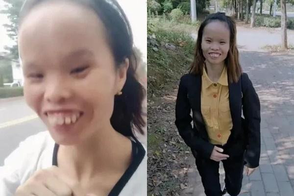 Nguoi phu nu xau nhat Tiktok giau kech xu, nhin chong moi kinh ngac