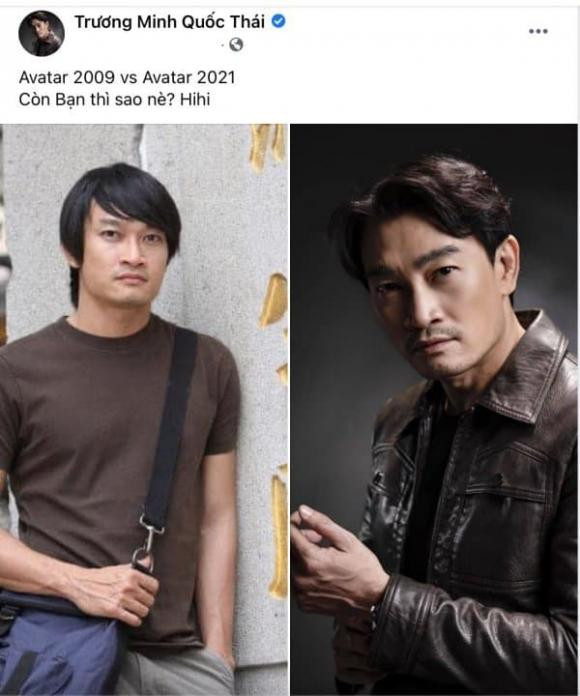 Ngoai hinh gay choang cua 