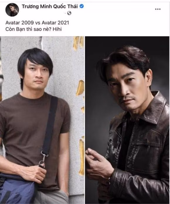 Ngoai hinh gay choang cua 