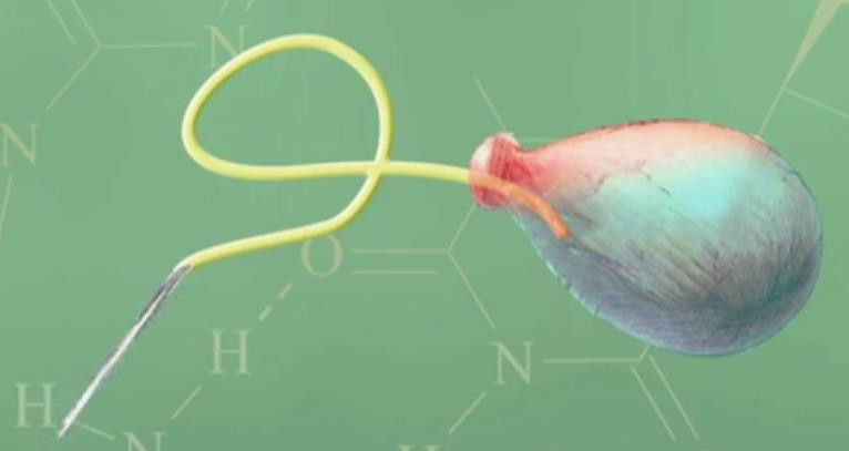 Quá khứ rùng rợn của kim tiêm - Hình 3 Qua khu rung ron cua kim tiem-Hinh-3