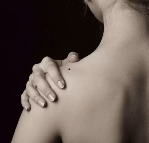 Vị trí nốt ruồi vẫy gọi thần Tài, hưởng lộc cả đời không hết Vi tri not ruoi vay goi than Tai, huong loc ca doi khong het