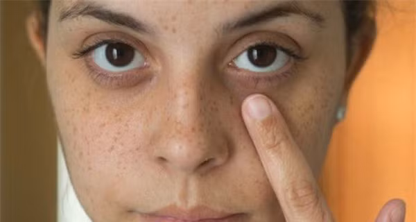 3 biểu hiện ở nữ giới ngầm cảnh báo tử cung đang có vấn đề - Hình 3 3 bieu hien o nu gioi ngam canh bao tu cung dang co van de-Hinh-3