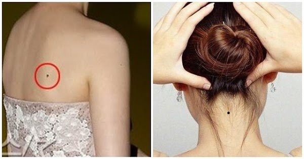 3 nốt ruồi cản trở tài lộc, 4 nốt ruồi phú quý đừng xóa đi - Hình 2 3 not ruoi can tro tai loc, 4 not ruoi phu quy dung xoa di-Hinh-2