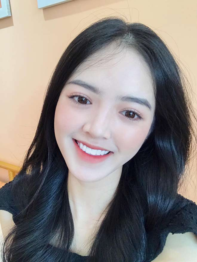 Cô gái mặt chi chít mụn lột xác 180 độ, xinh đẹp như thiên thần - Hình 5 Co gai mat chi chit mun lot xac 180 do, xinh dep nhu thien than-Hinh-5