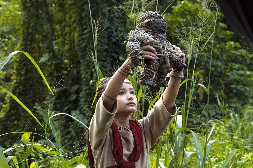 Ngoi sao nhi 9 tuoi bi diec bam sinh dong 