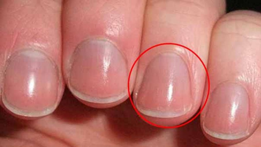 Người khỏe mạnh, sống trường thọ thường có 4 dấu hiệu trên bàn tay Nguoi khoe manh, song truong tho thuong co 4 dau hieu tren ban tay