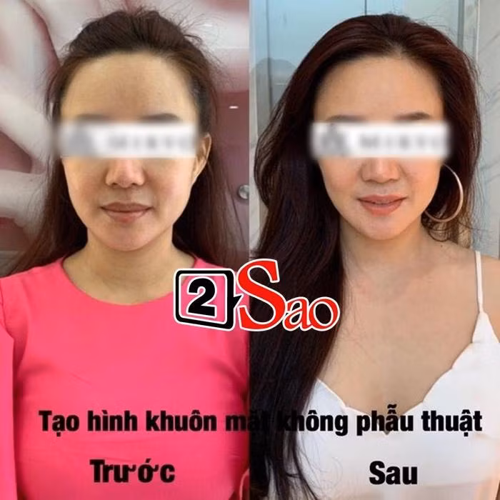 Khuyet diem cua Vy Oanh 