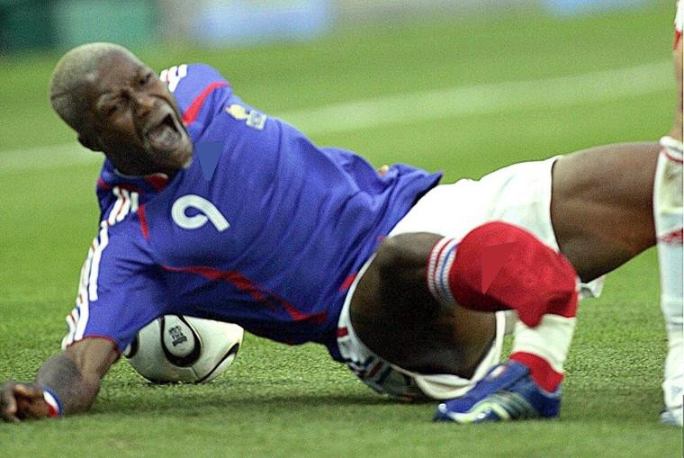 Tai nan bong da: Chan tay bien dang, xuong dam ra khoi thit-Hinh-3