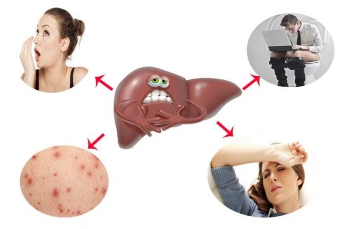 Dau hieu cho thay co the ban can duoc thai doc