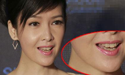 Dàn sao Hoa ngữ cứ cười là xấu: song Diệc tranh top 1 - Hình 11 Dan sao Hoa ngu cu cuoi la xau: song Diec tranh top 1-Hinh-11