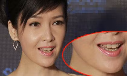 Dan sao Hoa ngu cu cuoi la xau: song Diec tranh top 1-Hinh-11