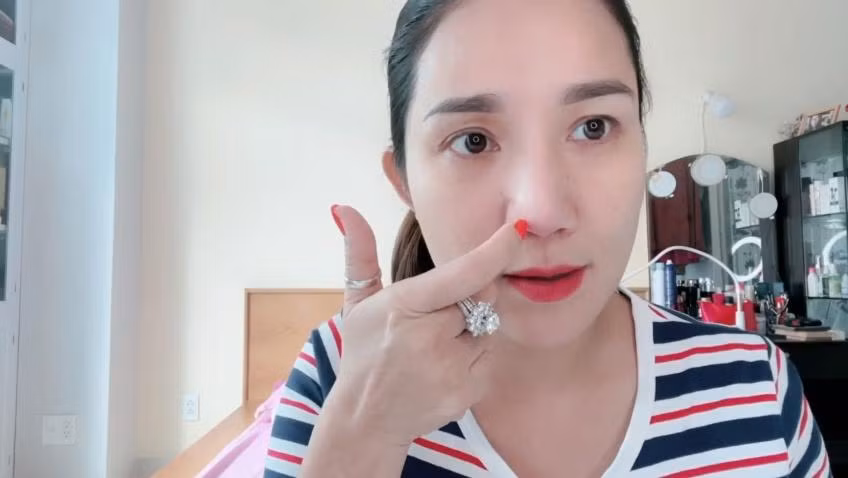 Cát Tường kể hành trình sửa mũi 5 lần và biến chứng đáng sợ - Hình 9 Cat Tuong ke hanh trinh sua mui 5 lan va bien chung dang so-Hinh-9