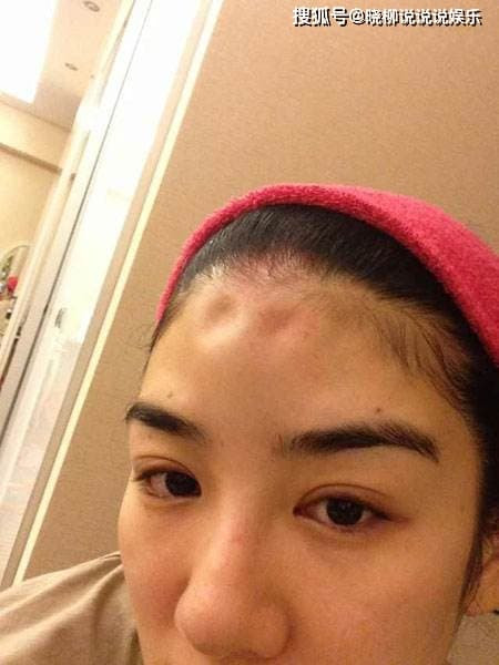 Huynh Dich: Bi chong danh den phai ngoi xe lan-Hinh-8