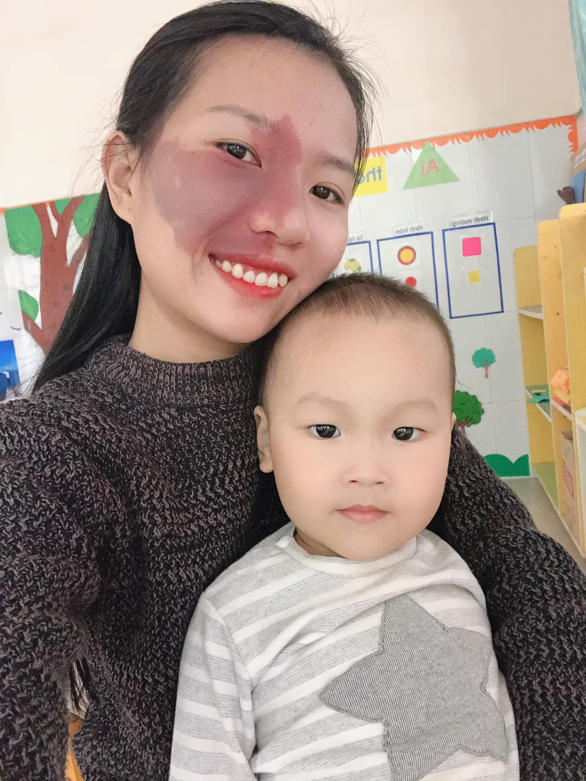 Vet bot lon tren mat la mon qua cua cha me-Hinh-3