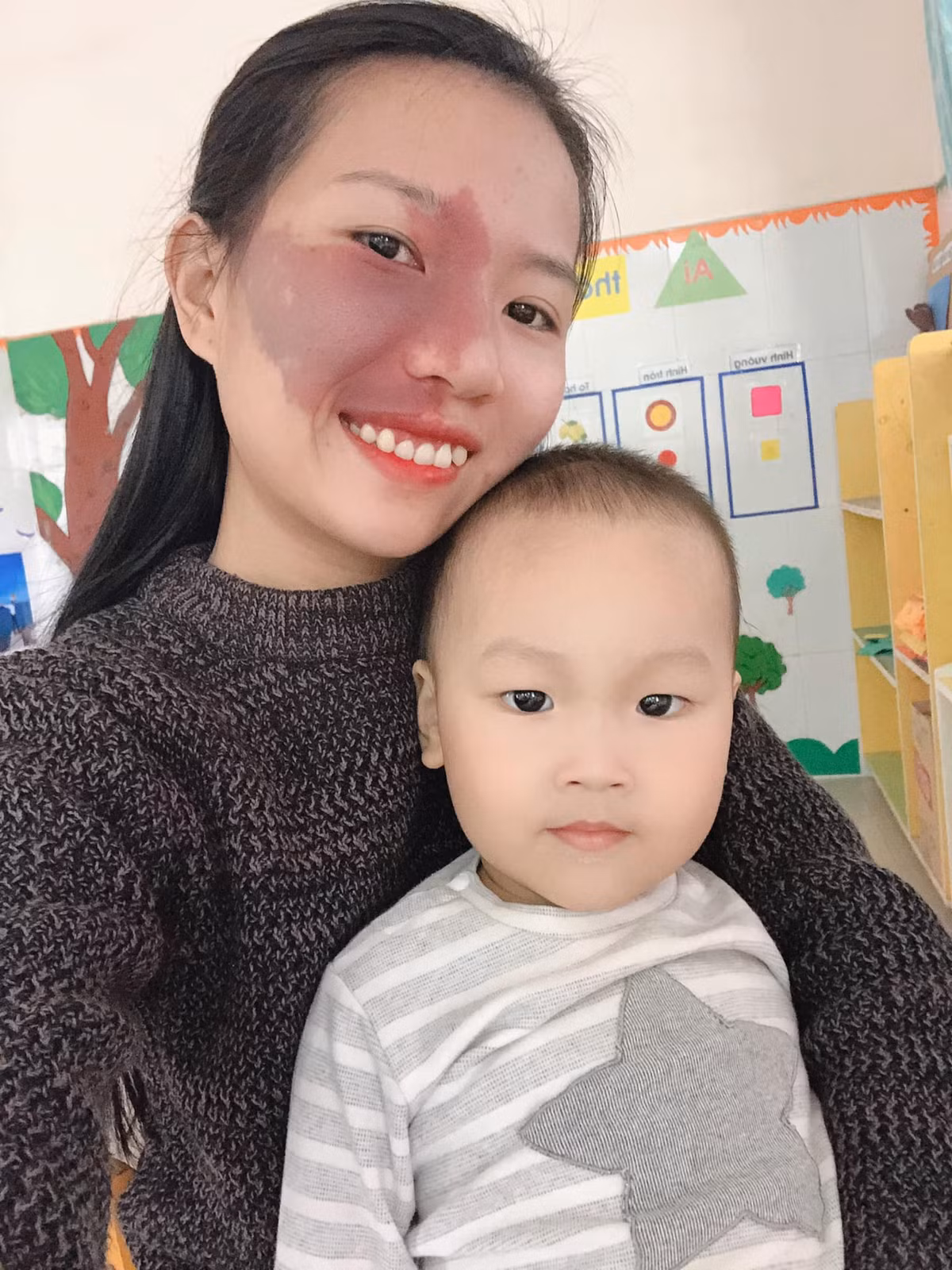 Vet bot lon tren mat la mon qua cua cha me-Hinh-3